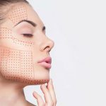Achieve Radiant Skin with Non-Invasive HIFU Treatment